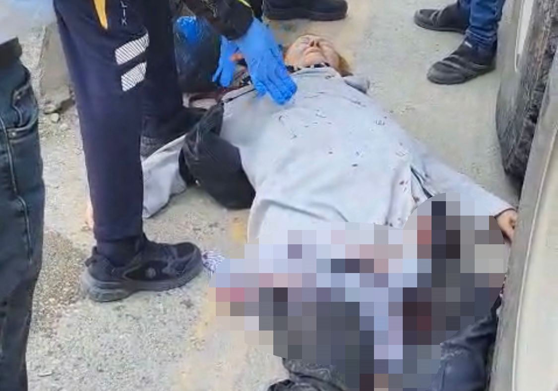 Malatya’da Trafik Kazalarında Bir Kişi Hayatını Kaybetti, Bir Kişi Ağır Yaralandı