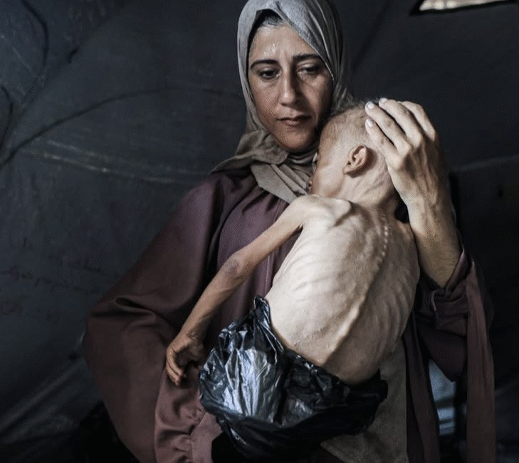 Gazze’nin Sessiz Çığlığı: Çocuklar Açlıktan Ölüyor. Gazze Şeridi, İsrail’in 7