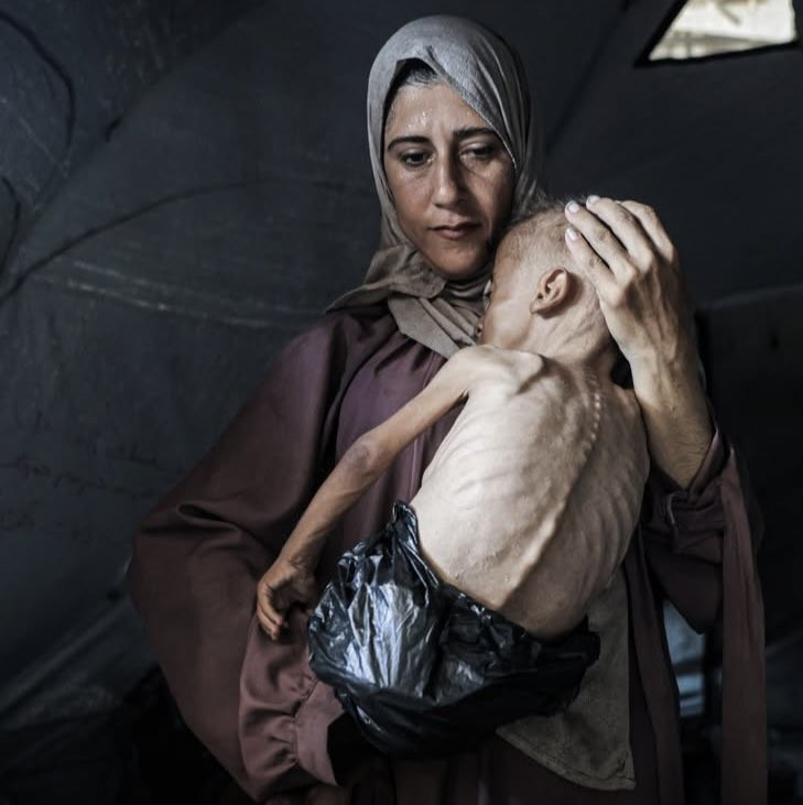 Gazze’nin Sessiz Çığlığı: Çocuklar Açlıktan Ölüyor. Gazze Şeridi, İsrail’in 7
